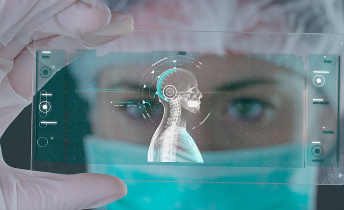 implantes bioelectrónicos