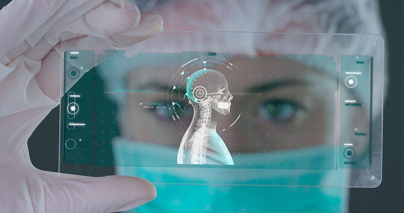 implantes bioelectrónicos