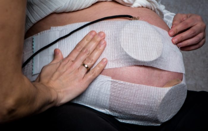 eurecat treematernity cinturons de monitoratge fetal