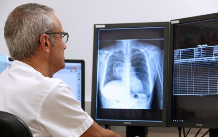 eurecat LuCaDAlert deep learning