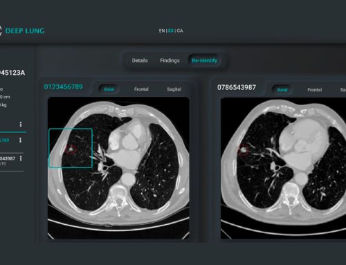 Eurecat apunta al potencial de la inteligencia artificial, la robótica y la sensórica para avanzar hacia una salud más preventiva, equitativa y personalizada